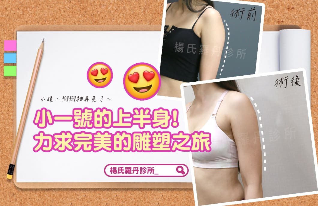 【雷射減脂】小一號的上半身！力求完美的雕塑之旅～